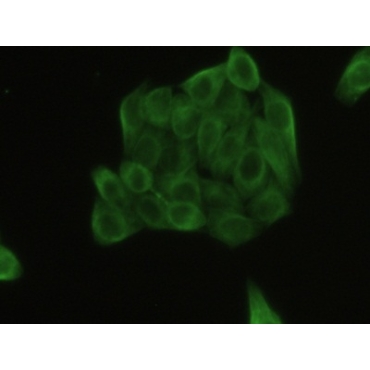 Tubulin Beta (TUBb) Human Polyclonal Antibody