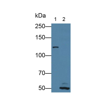 Xeroderma Pigmentosum, Complementation Group G (XPG) Human Polyclonal Antibody