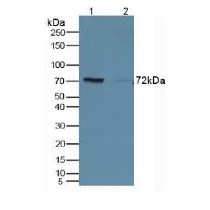 Cluster Of Differentiation 19 (CD19) Human Polyclonal Antibody