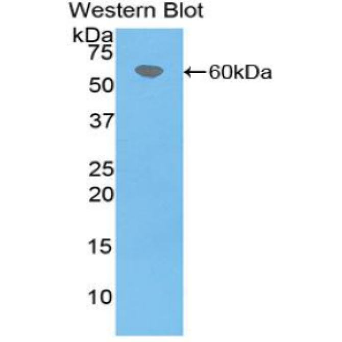 Coagulation Factor VII (F7) Bovine (Cattle) Polyclonal Antibody