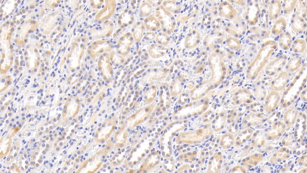 Coagulation Factor VII (F7) Rabbit Polyclonal Antibody