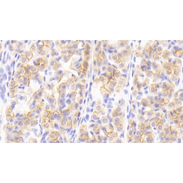 Cytokeratin 13 (CK13) Human Polyclonal Antibody