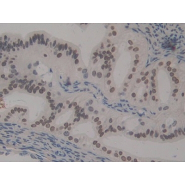 High Mobility Group Nucleosome Binding Domain Protein 1 (HMGN1) Mouse Polyclonal Antibody