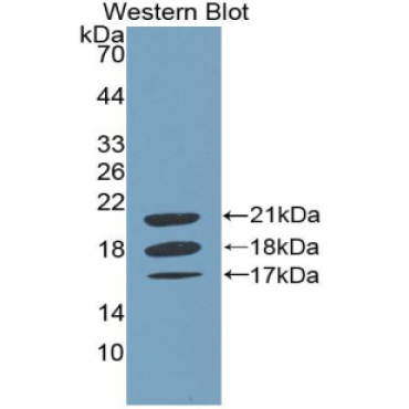 Coagulation Factor VIII (F8) Canis familiaris; Canine (Dog) Polyclonal Antibody