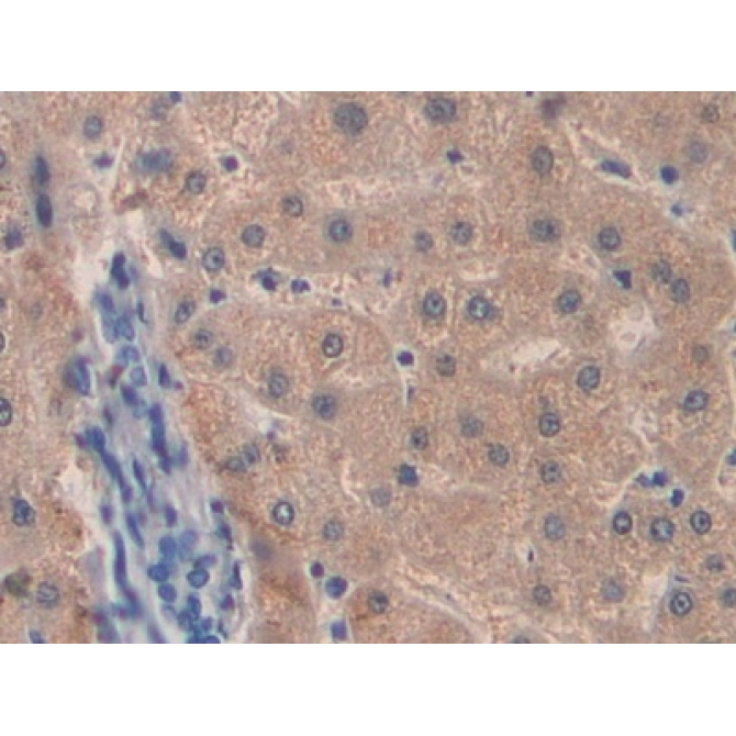Coagulation Factor VIII (F8) Human Polyclonal Antibody