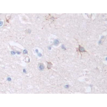 Coagulation Factor VIII (F8) Human Polyclonal Antibody