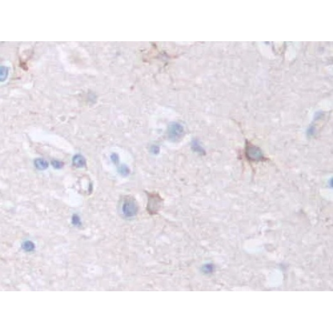 Coagulation Factor VIII (F8) Human Polyclonal Antibody