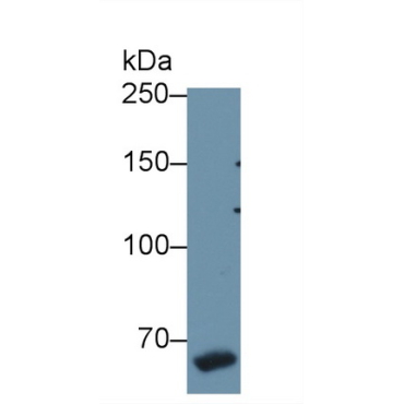 Coagulation Factor VIII (F8) Mouse Polyclonal Antibody