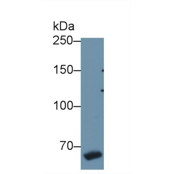 Coagulation Factor VIII (F8) Mouse Polyclonal Antibody
