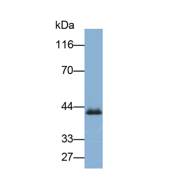 Coagulation Factor VIII (F8) Mouse Polyclonal Antibody