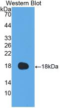 Coagulation Factor VIII (F8) Pig Polyclonal Antibody