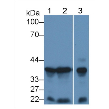 Fibroblast Growth Factor 10 (FGF10) Mouse Polyclonal Antibody