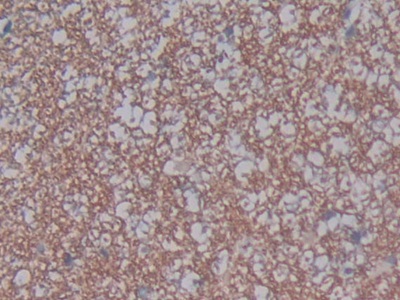 Angiotensin I Converting Enzyme 2 (ACE2) Rat Polyclonal Antibody