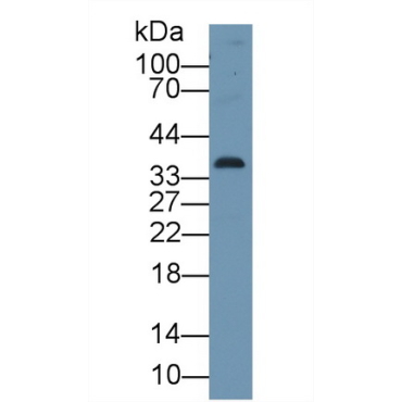 Cyclin Dependent Kinase 1 (CDK1) Human Polyclonal Antibody