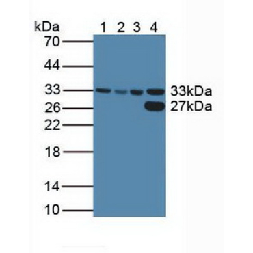Cyclin Dependent Kinase 2 (CDK2) Human Polyclonal Antibody