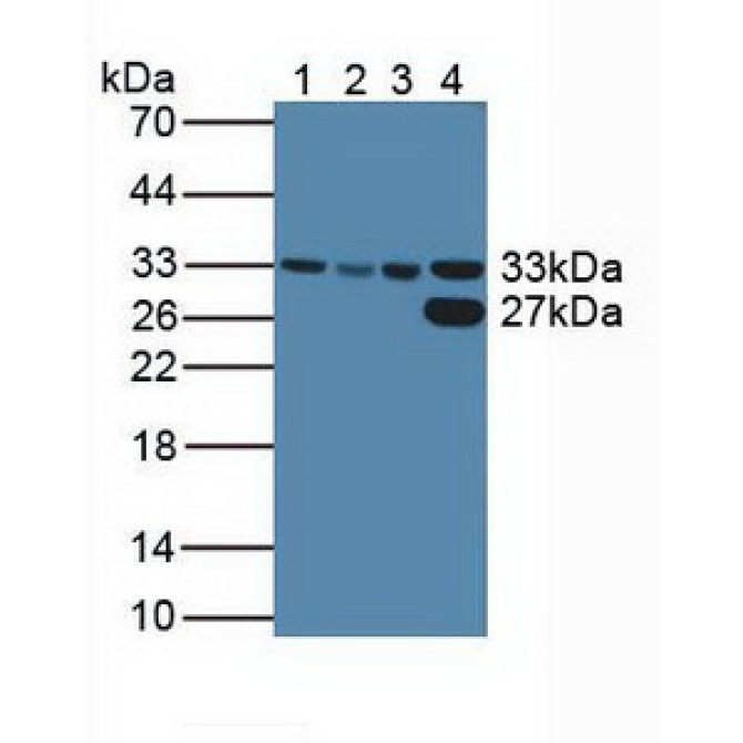 Cyclin Dependent Kinase 2 (CDK2) Human Polyclonal Antibody