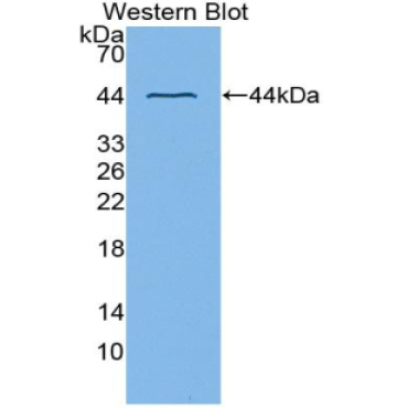 Cyclin Dependent Kinase 2 (CDK2) Human Polyclonal Antibody