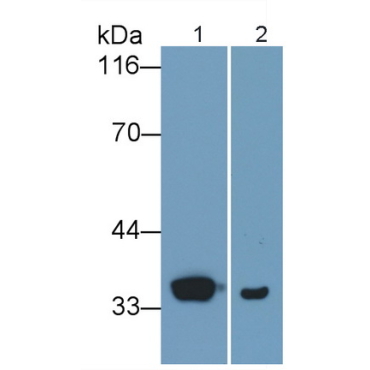 Cyclin Dependent Kinase 2 (CDK2) Human Polyclonal Antibody