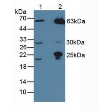 Mannose Associated Serine Protease 1 (MASP1) Human Polyclonal Antibody