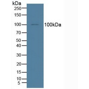 Insulin Degrading Enzyme (IDE) Human Polyclonal Antibody