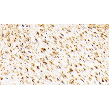 Oxidosqualene Cyclase (OSC) Human Polyclonal Antibody