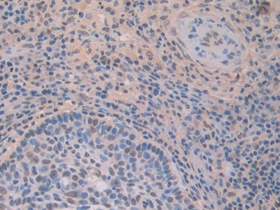Interferon Gamma Inducible Protein 16 (IFI16) Human Polyclonal Antibody