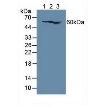 Interleukin 7 Receptor (IL7R) Human Polyclonal Antibody