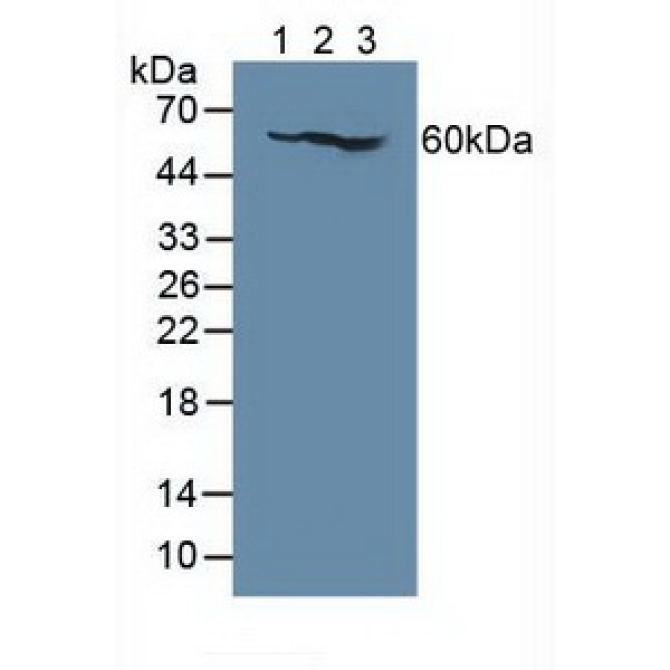 Interleukin 7 Receptor (IL7R) Human Polyclonal Antibody