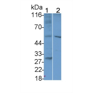 Interleukin 7 Receptor (IL7R) Mouse Polyclonal Antibody