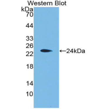 Aggrecan (AGC) Human Polyclonal Antibody