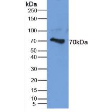 Aggrecan (AGC) Human Polyclonal Antibody