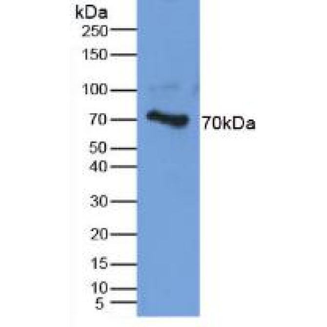 Aggrecan (AGC) Human Polyclonal Antibody