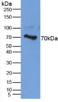 Aggrecan (AGC) Human Polyclonal Antibody
