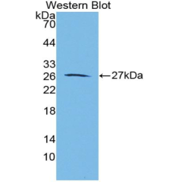 Aggrecan (AGC) Human Polyclonal Antibody