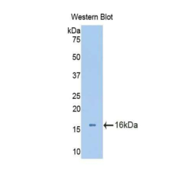 Aggrecan (AGC) Mouse Polyclonal Antibody