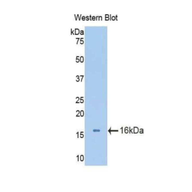 Aggrecan (AGC) Mouse Polyclonal Antibody