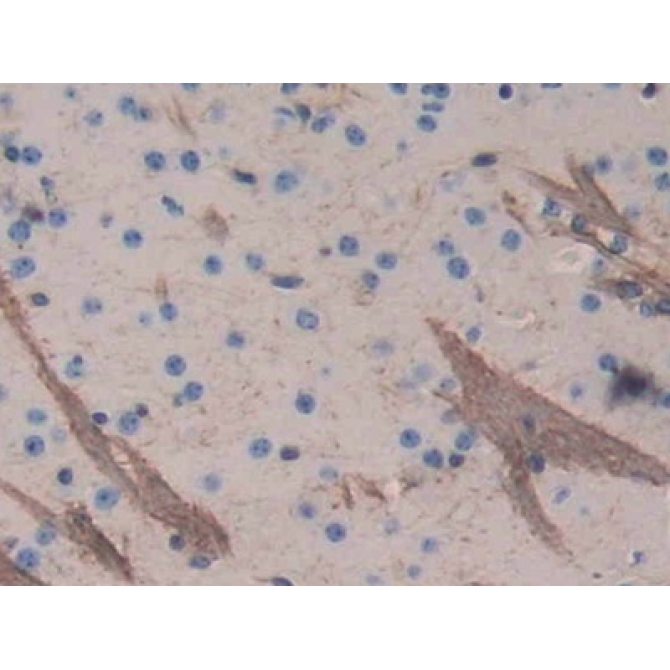 Aggrecan (AGC) Mouse Polyclonal Antibody