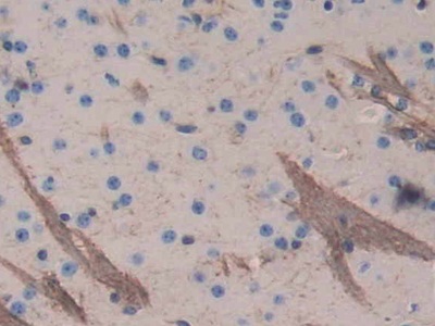 Aggrecan (AGC) Mouse Polyclonal Antibody