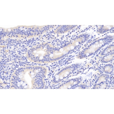 p53 Upregulated Modulator Of Apoptosis (PUMA) Human Polyclonal Antibody