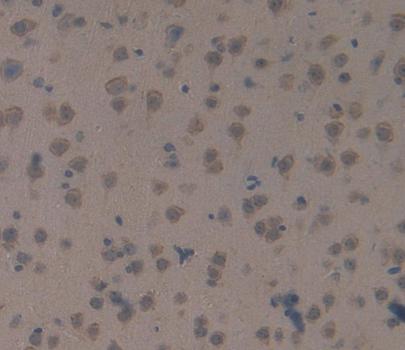 S Antigen (SAG) Mouse Polyclonal Antibody