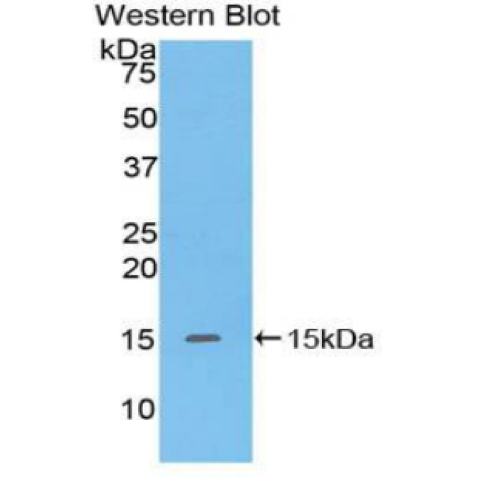 Defensin Alpha 5, Paneth Cell Specific (DEFa5) Human Polyclonal Antibody