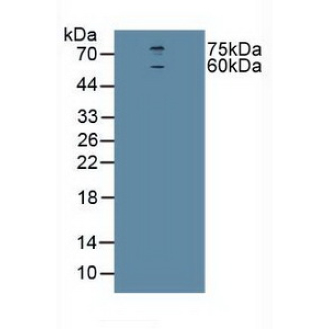 Cholinergic Receptor, Nicotinic, Alpha 4 (CHRNa4) Human Polyclonal Antibody
