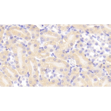 Cholinergic Receptor, Nicotinic, Alpha 4 (CHRNa4) Mouse Polyclonal Antibody