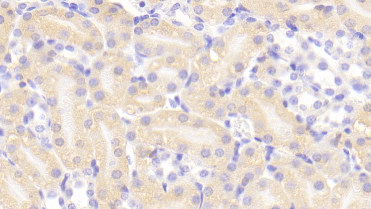 Cholinergic Receptor, Nicotinic, Alpha 4 (CHRNa4) Mouse Polyclonal Antibody