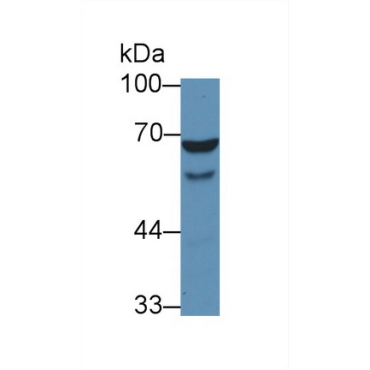 Wiskott Aldrich Syndrome Protein (WASP) Human Polyclonal Antibody