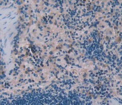 Wiskott Aldrich Syndrome Protein (WASP) Rat Polyclonal Antibody
