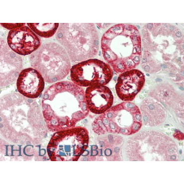 NADPH Oxidase 4 (NOX4) Human Polyclonal Antibody