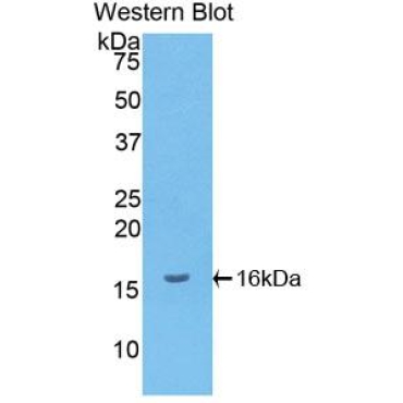 Monokine Induced By Interferon Gamma (MIg) Human Polyclonal Antibody