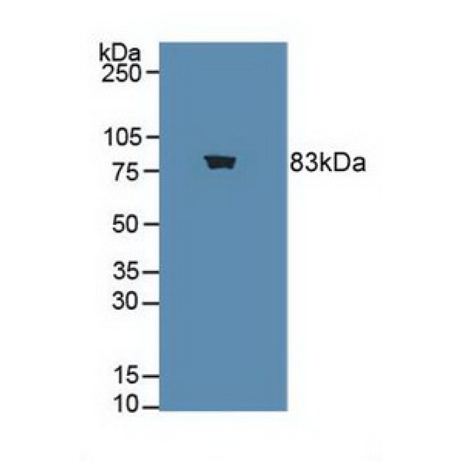 Choline Acetyltransferase (ChAT) Human Polyclonal Antibody