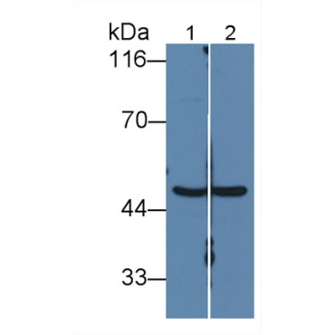 Fumarase (FUM) Human Polyclonal Antibody
